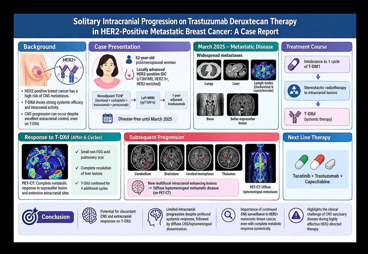 Solitary Intracranial Progression on Trastuzumab Deruxtecan Therapy in HER2-Positive Metastatic Brea...